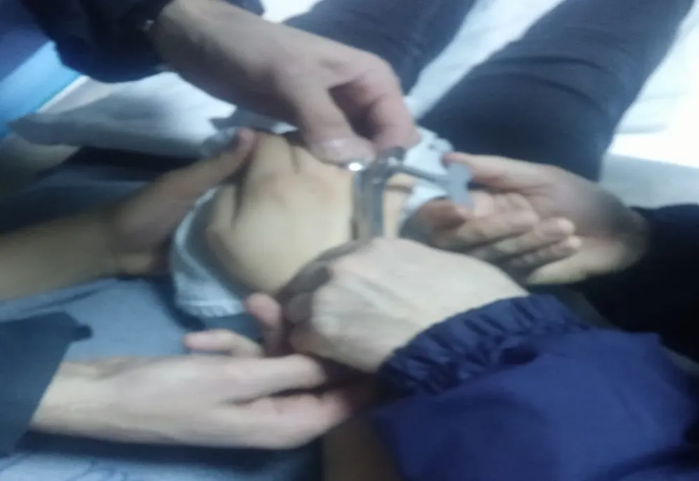Pompieri chemați de medici pentru a scoate un inel de pe degetul unui copil
