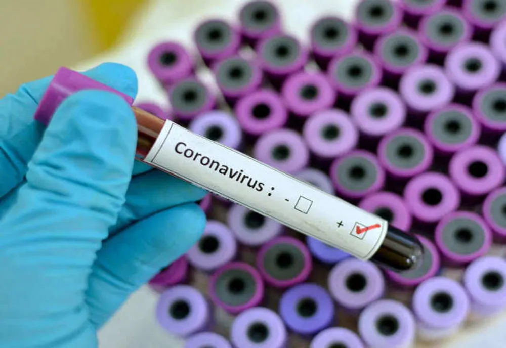 393 de botoșăneni infectați din care 180 de cadre medicale