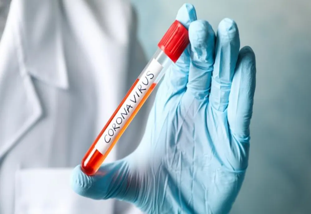 Au încurcat decesele. Asistenta de la Infecțioase nu a murit de COVID