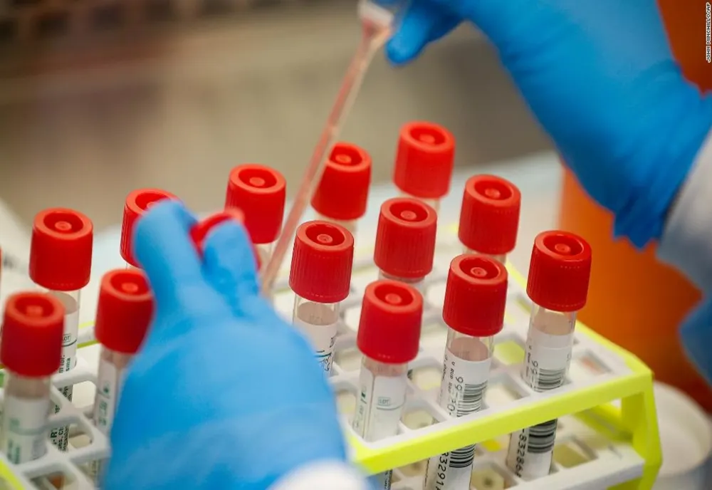 Cinci cazuri noi de coronavirus în Botoșani. 743 de persoane s-au vindecat