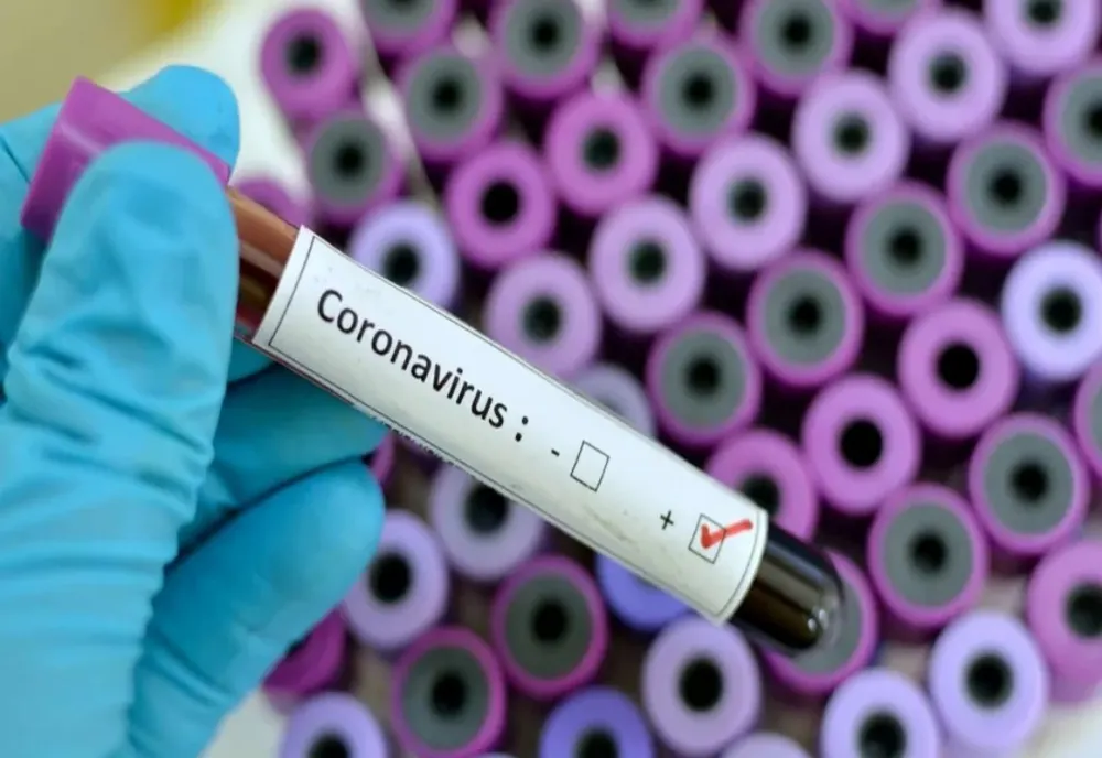 COVID. 954 de cazuri înregistrate în Botoșani, 23.730 la nivel național