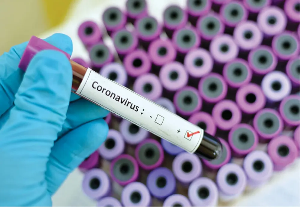 Bilanț coronavirus: 825 de cazuri noi și 37 de decese