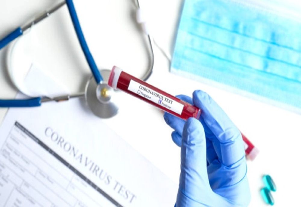 1.328 de cazuri noi de persoane infectate cu virusul COVID – 19, 50 de decese în ultimele 24 de ore