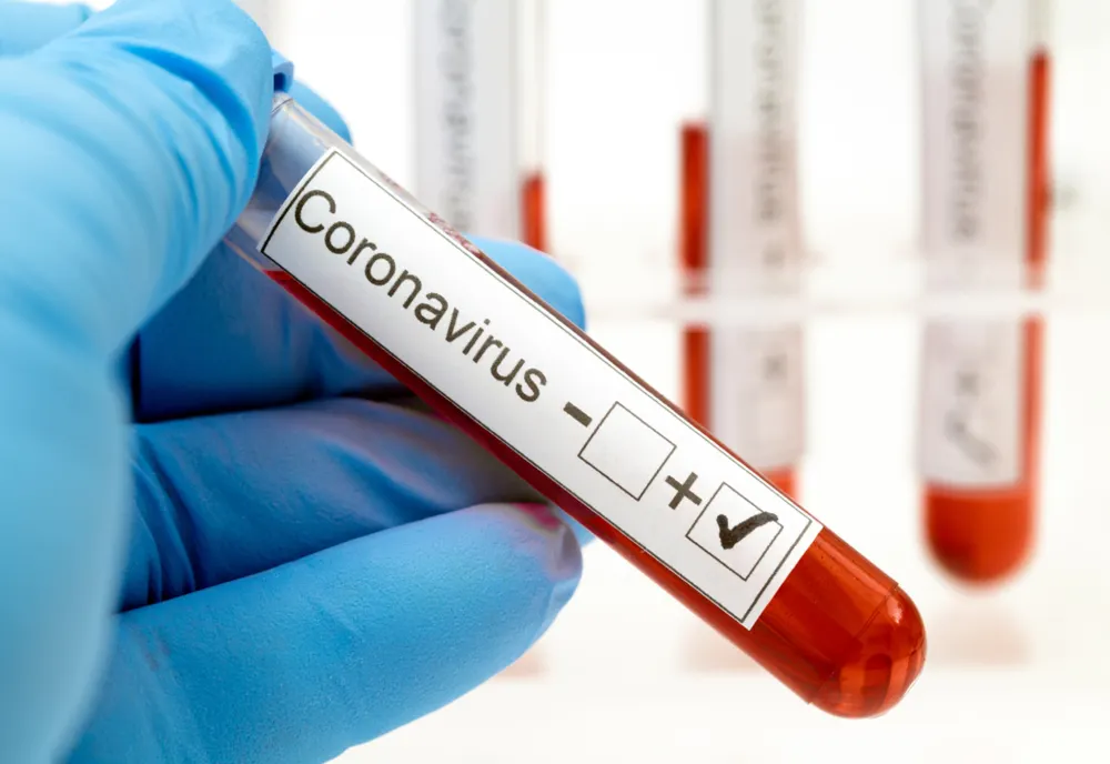 Numărul botoșănenilor infectați cu COVID se apropie de 600