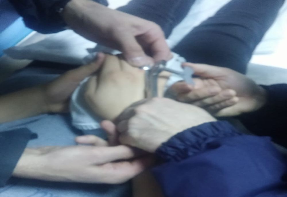 Pompieri chemați de medici pentru a scoate un inel de pe degetul unui copil