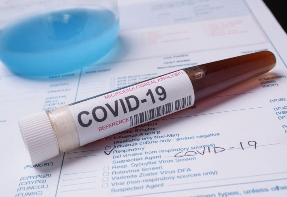 Încă cinci botoșăneni infectați cu coronavirus