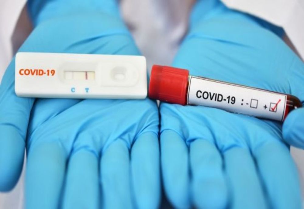 Aproape 500 de persoane infectate în județul Botoșani