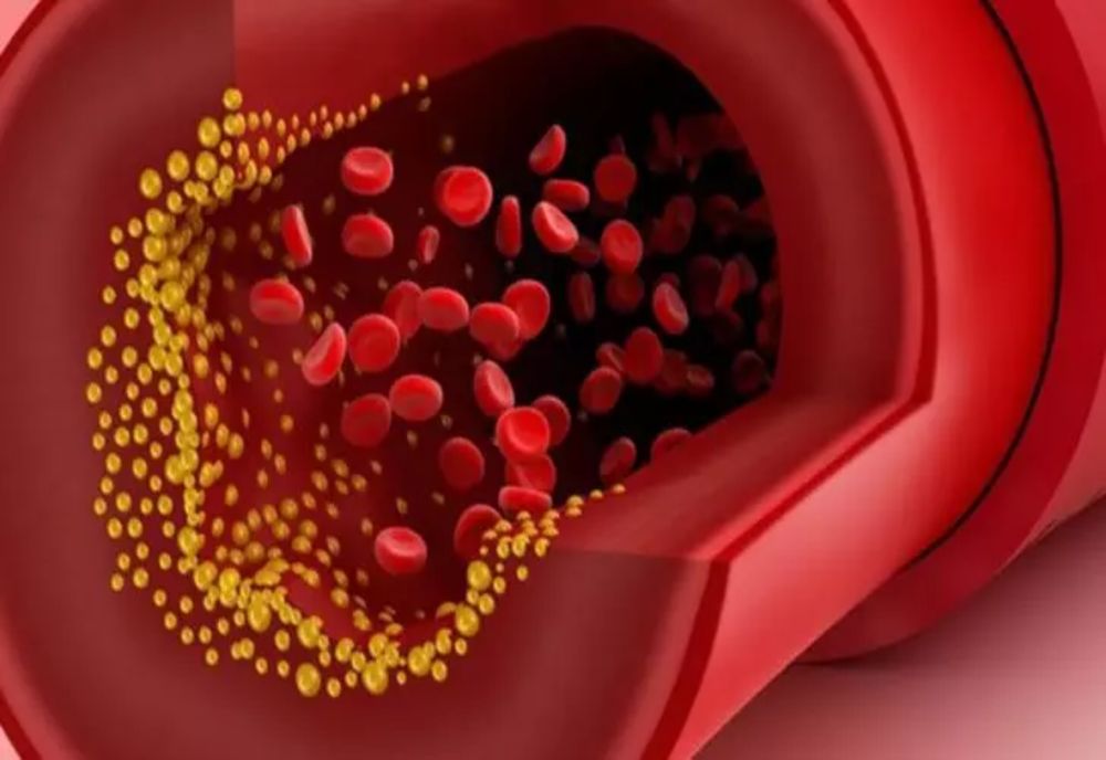 Alimentele care curăță vasele de sânge de colesterol și reduc riscul de infarct