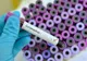 CORONAVIRUS. 279 persoane autoizolate și 39 în carantină, în județul Botoșani