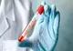 771 de decese provocate de coronavirus
