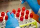 Cinci cazuri noi de coronavirus în Botoșani. 743 de persoane s-au vindecat